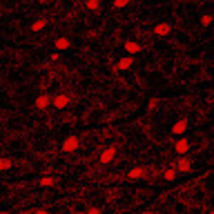 Meet your Posher, Praveena